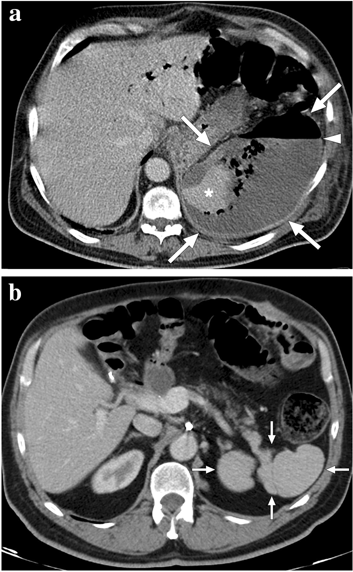 Fig. 23