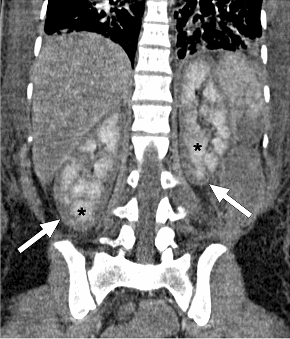 Fig. 18