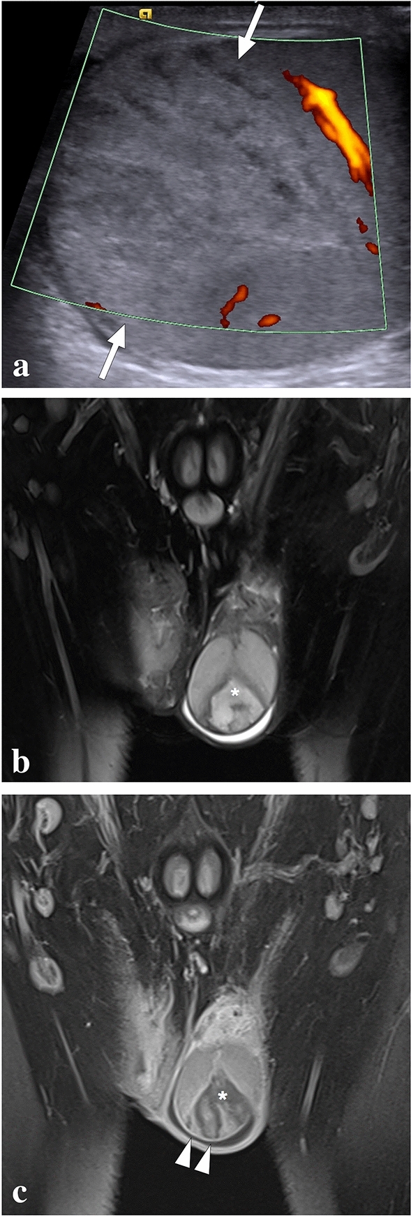 Fig. 37