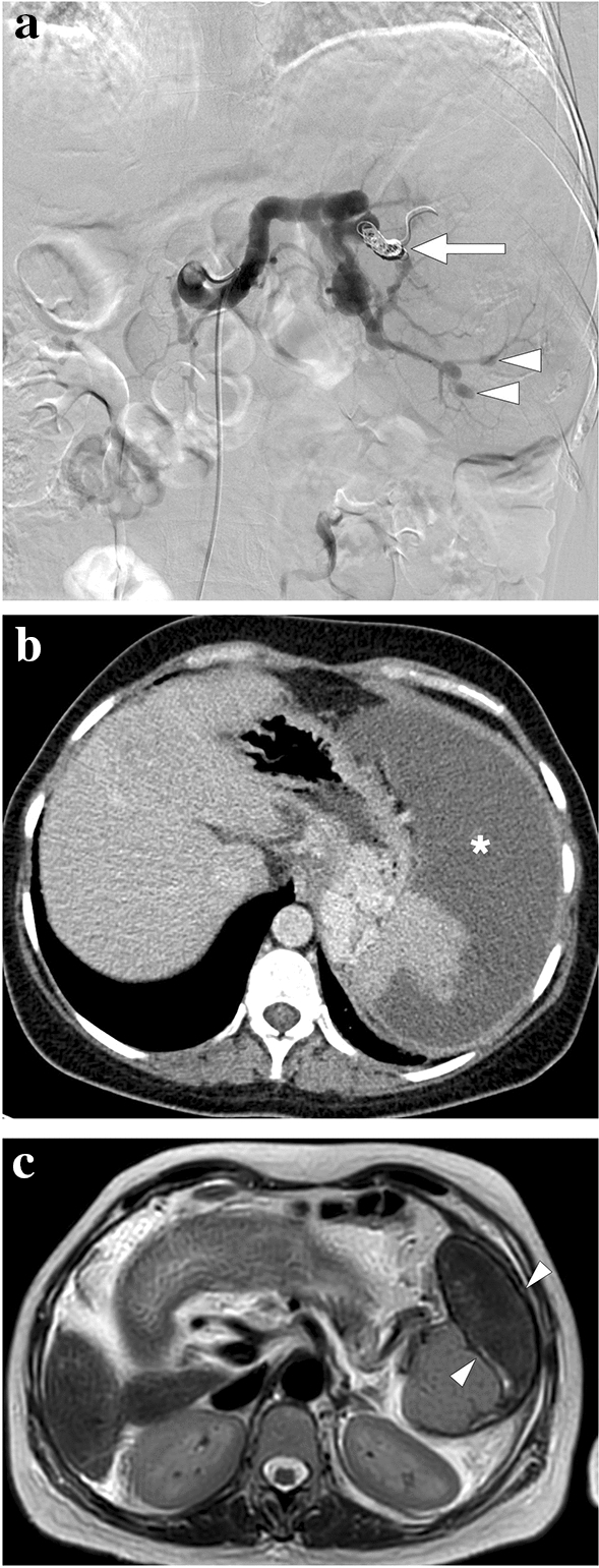 Fig. 24