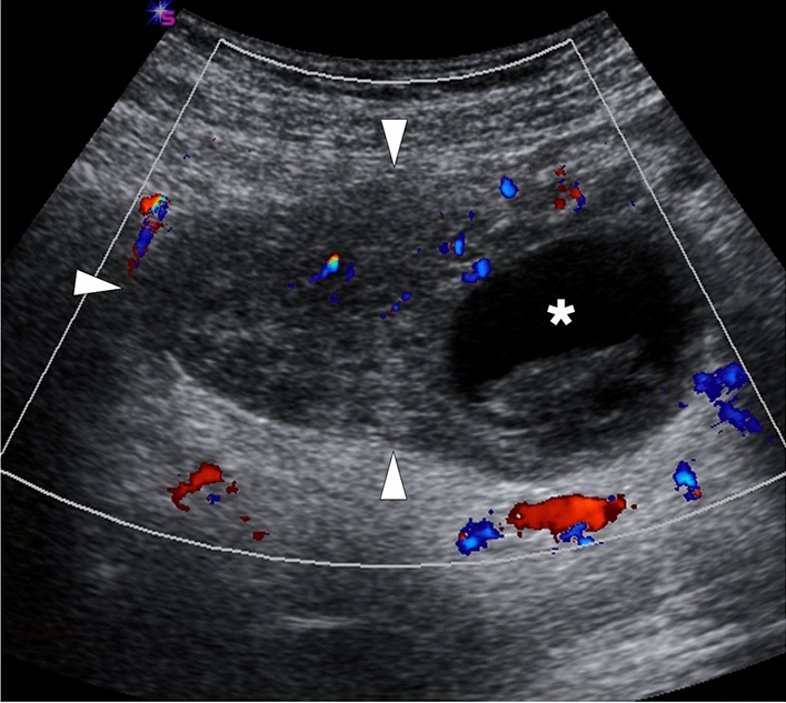 Fig. 34