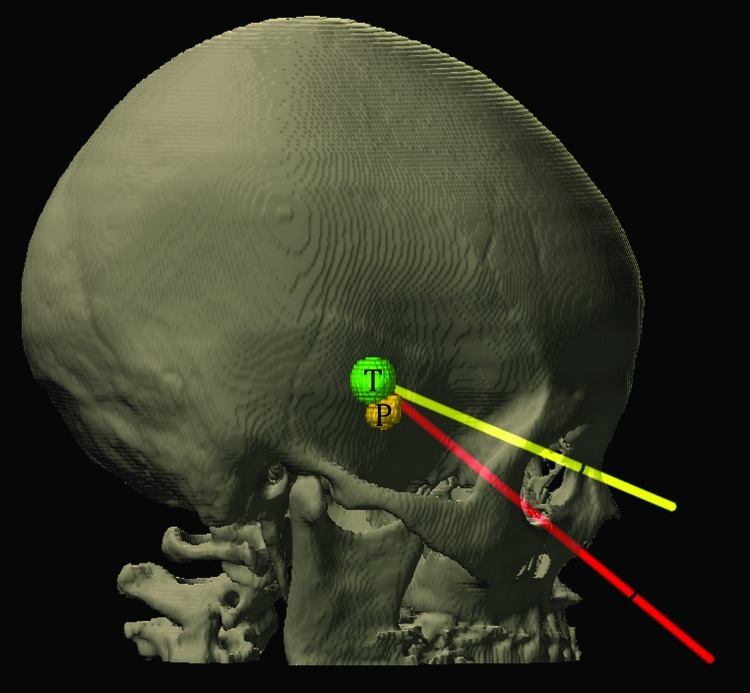 Fig. 11