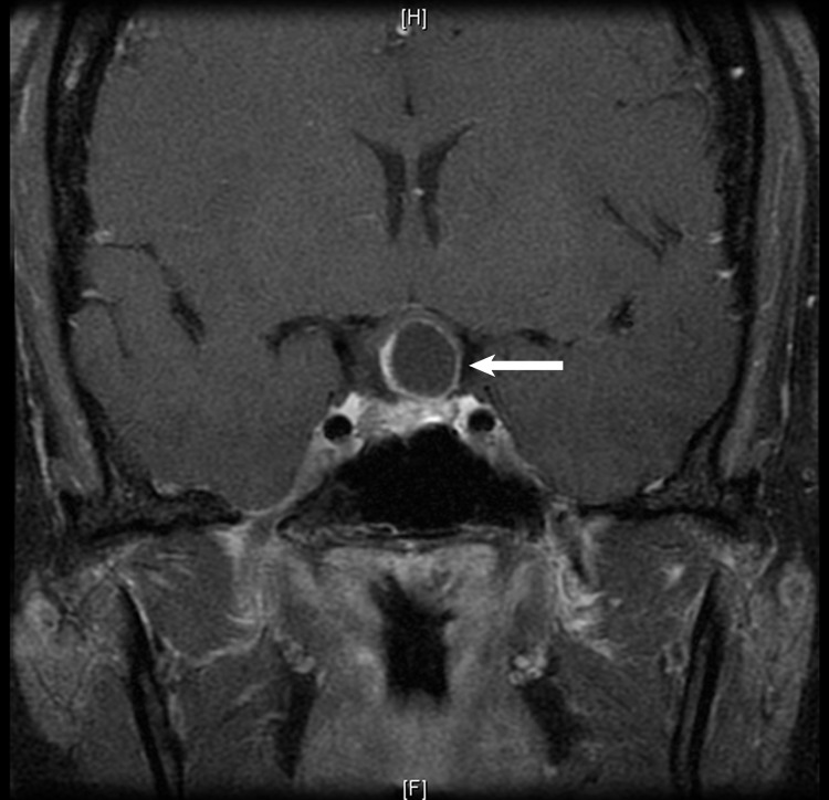 Fig. 10