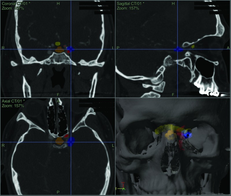 Fig. 2