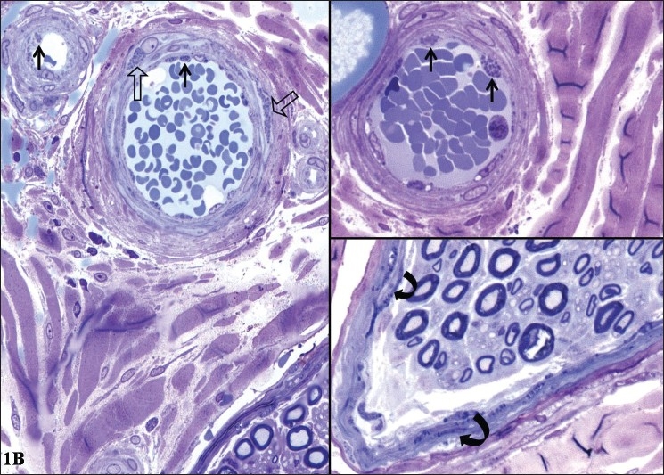 Figure 2B