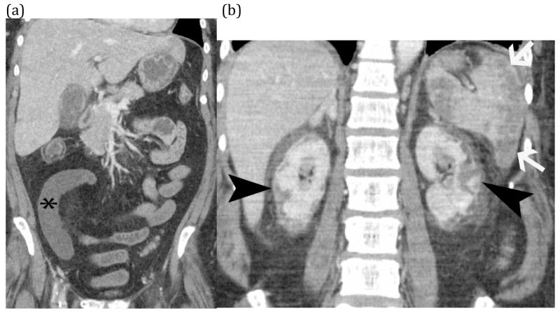 FIGURE 19 (a) and (b)