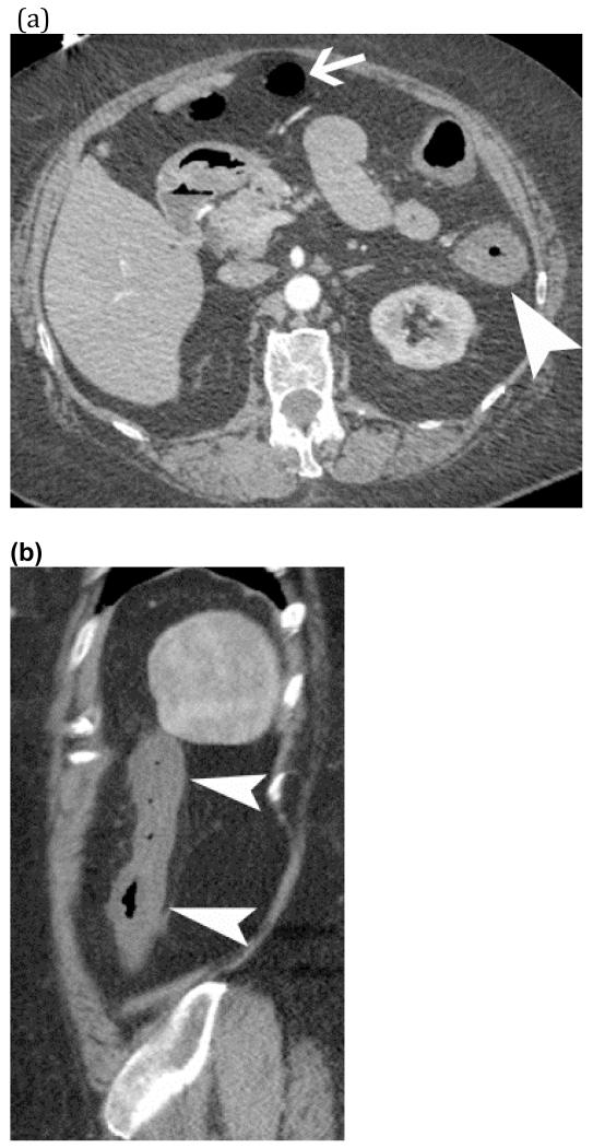 FIGURE 20