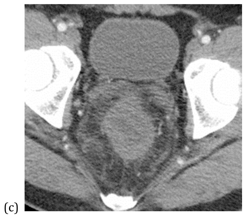 Figure 17