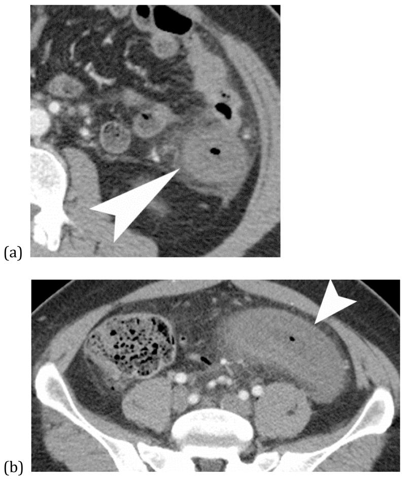 Figure 17