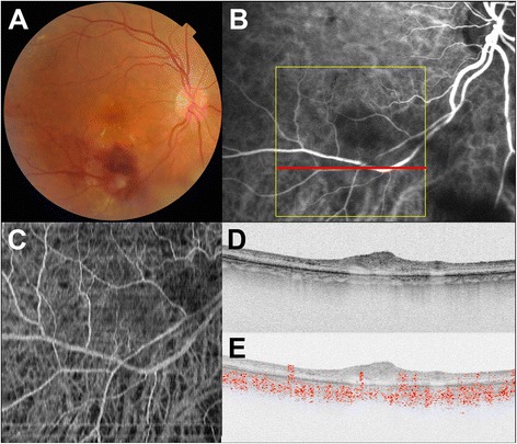 Fig. 3