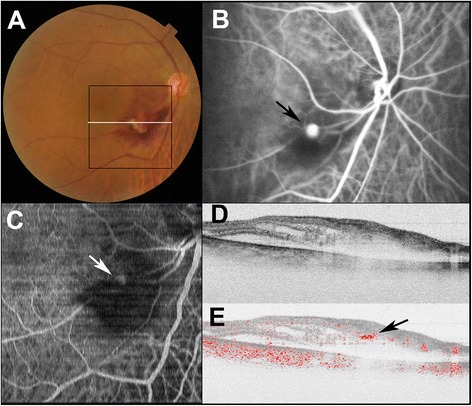 Fig. 1