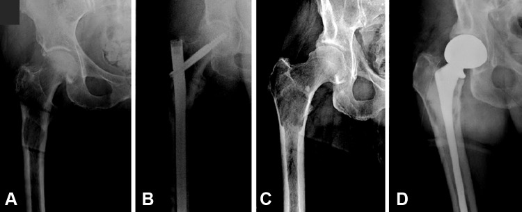 Fig. 1A–D