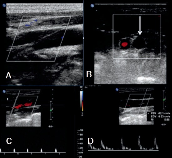 Figure 4.