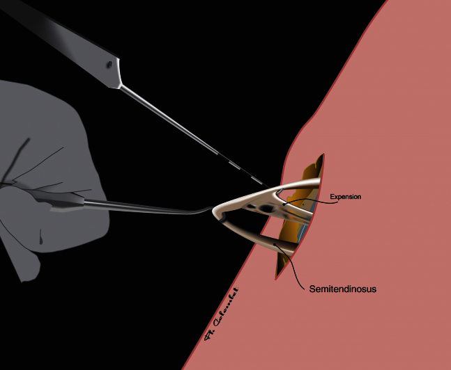 Fig 5