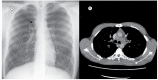 Figure 1 -
