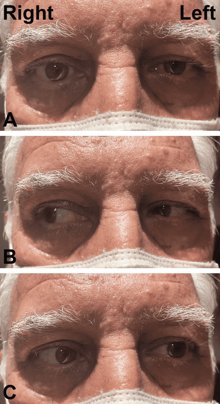 gabapentin twice a day