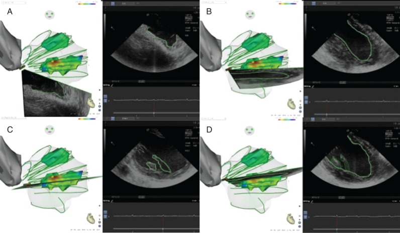 Figure 1