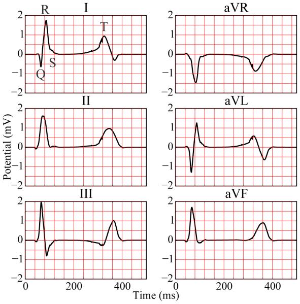 Figure 11