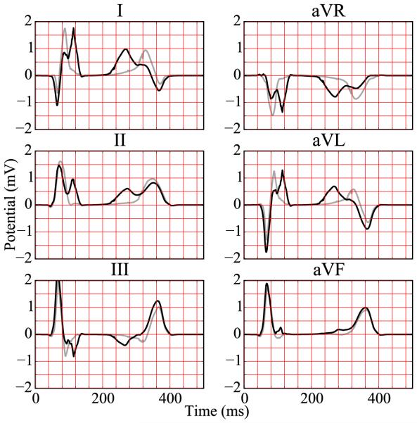 Figure 12