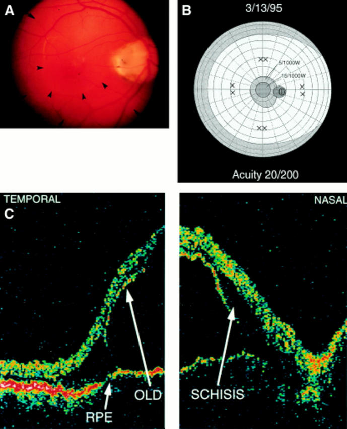 Figure 1  