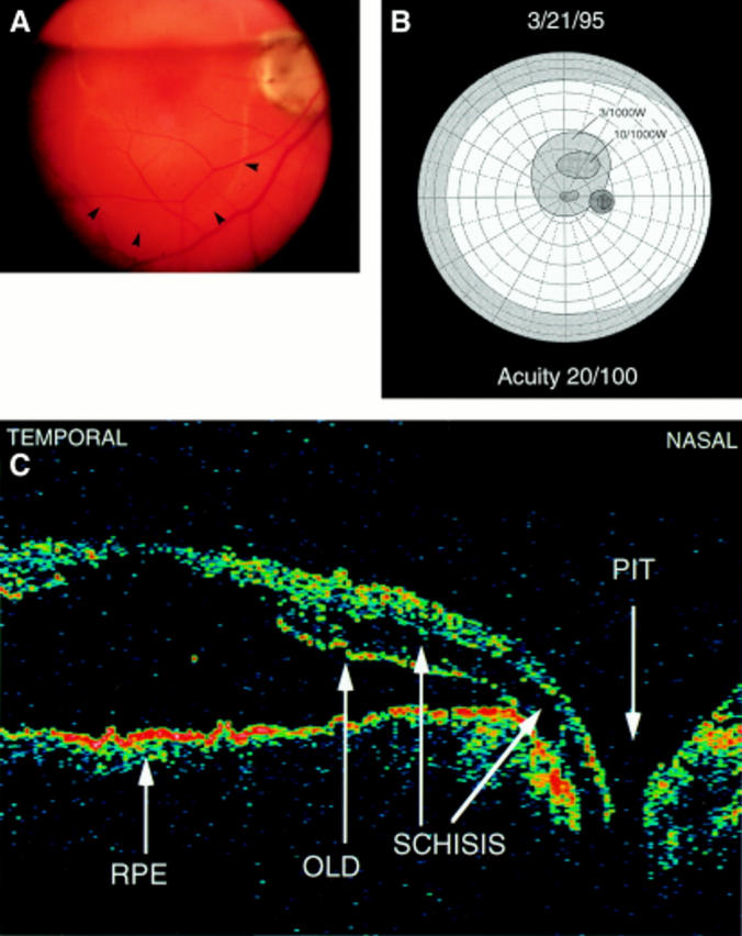 Figure 2  