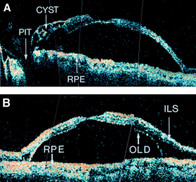 Figure 4  