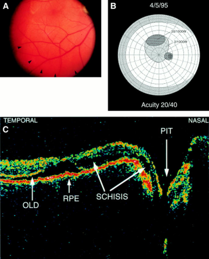 Figure 3  