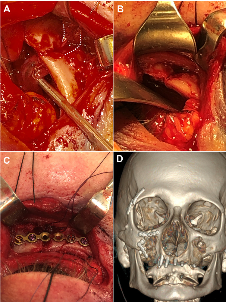 Figure 2.