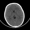 Fig 1.