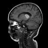 Fig 3.