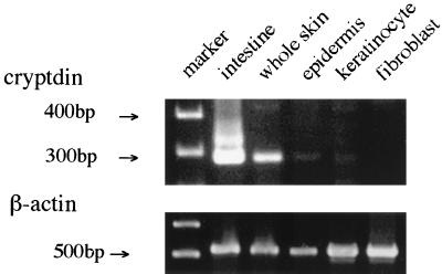 FIG. 1