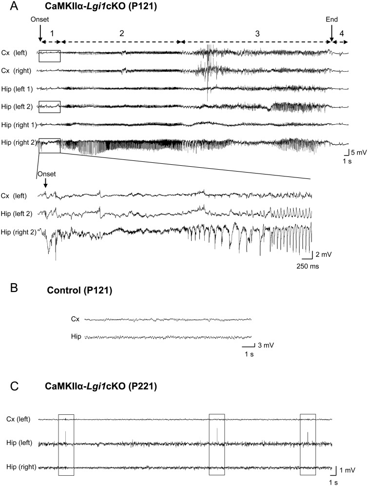 Glutamatergic neuron-targeted loss of LGI1 epilepsy gene results in ...