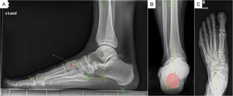 Fig. 2