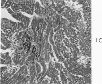 Fig. 1C