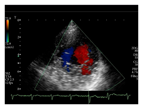 Figure 2