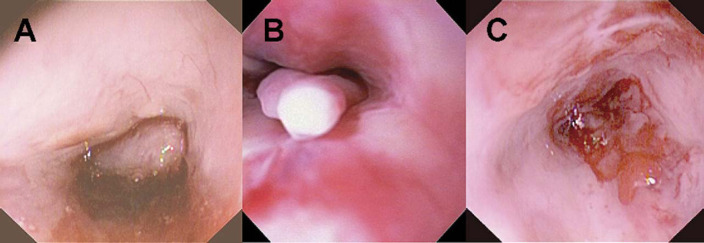 Fig 1.