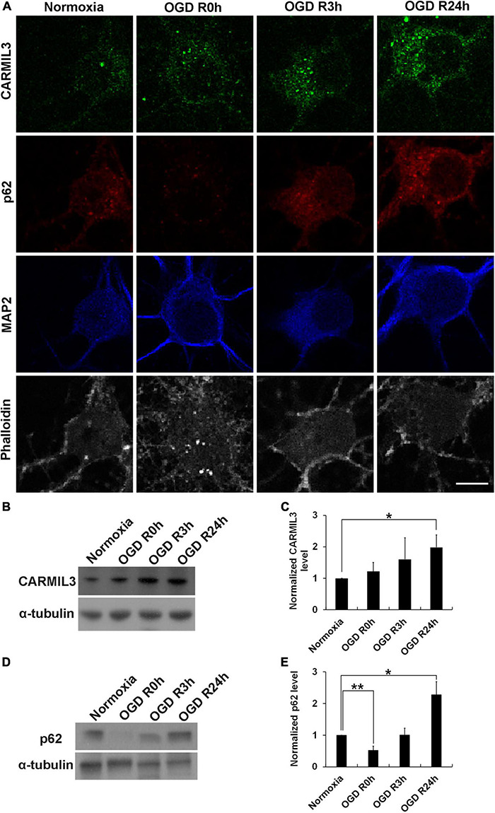 FIGURE 11