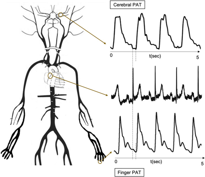 FIGURE 3