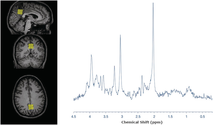 FIGURE 1