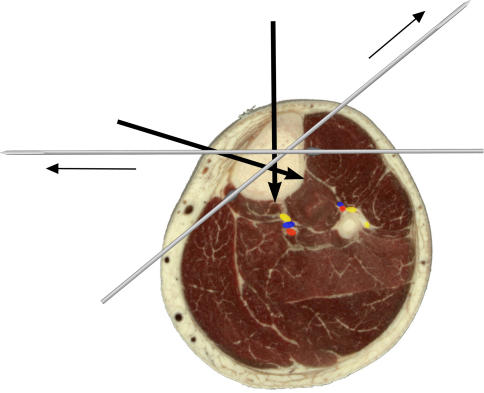 Fig. 5