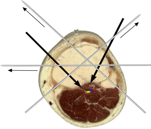 Fig. 3