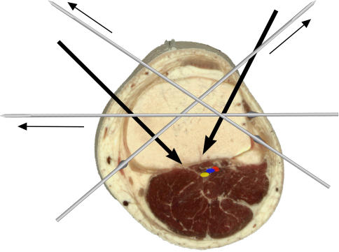 Fig. 2