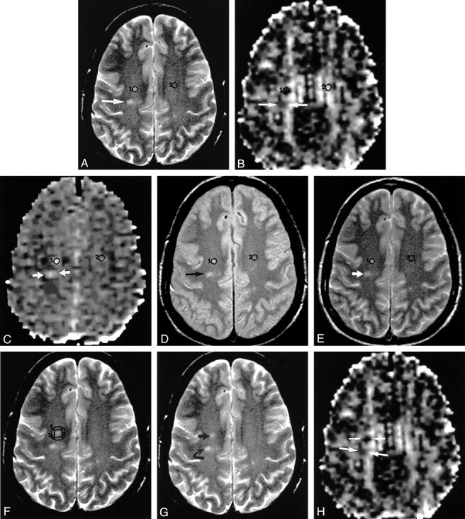 fig 1.