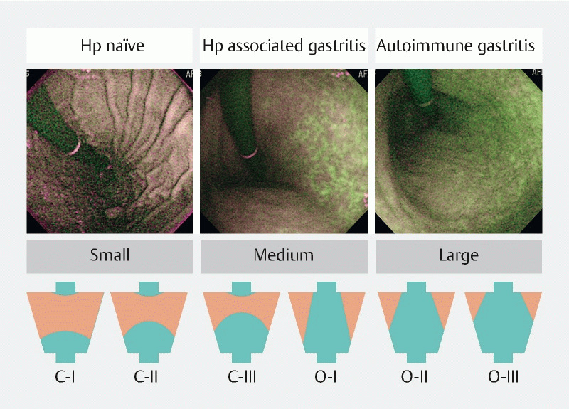 Fig. 1 