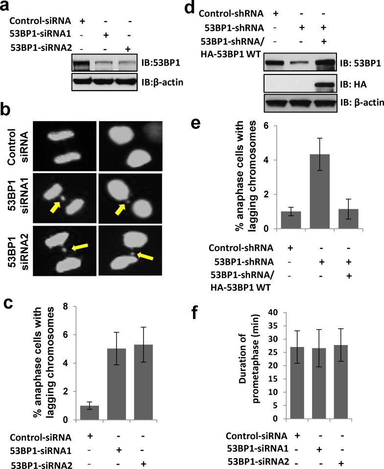 Aurora kinase B dependent phosphorylation of 53BP1 is required for ...