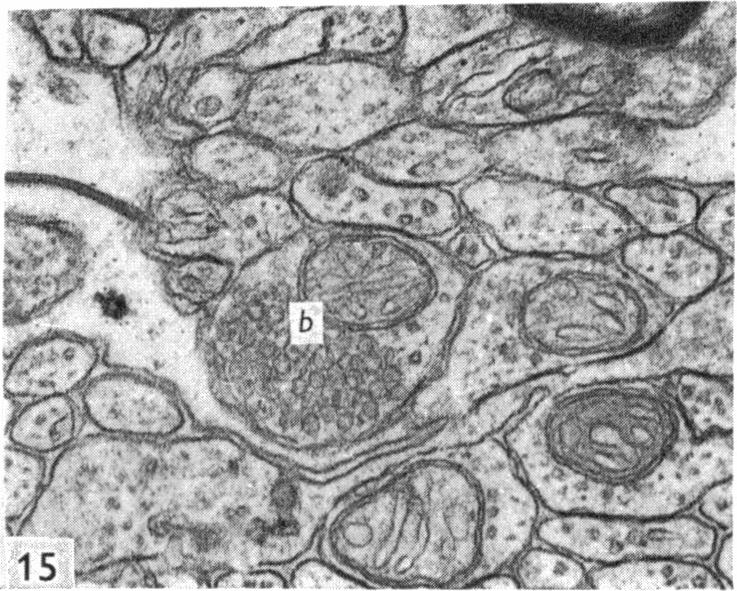 Fig. 15