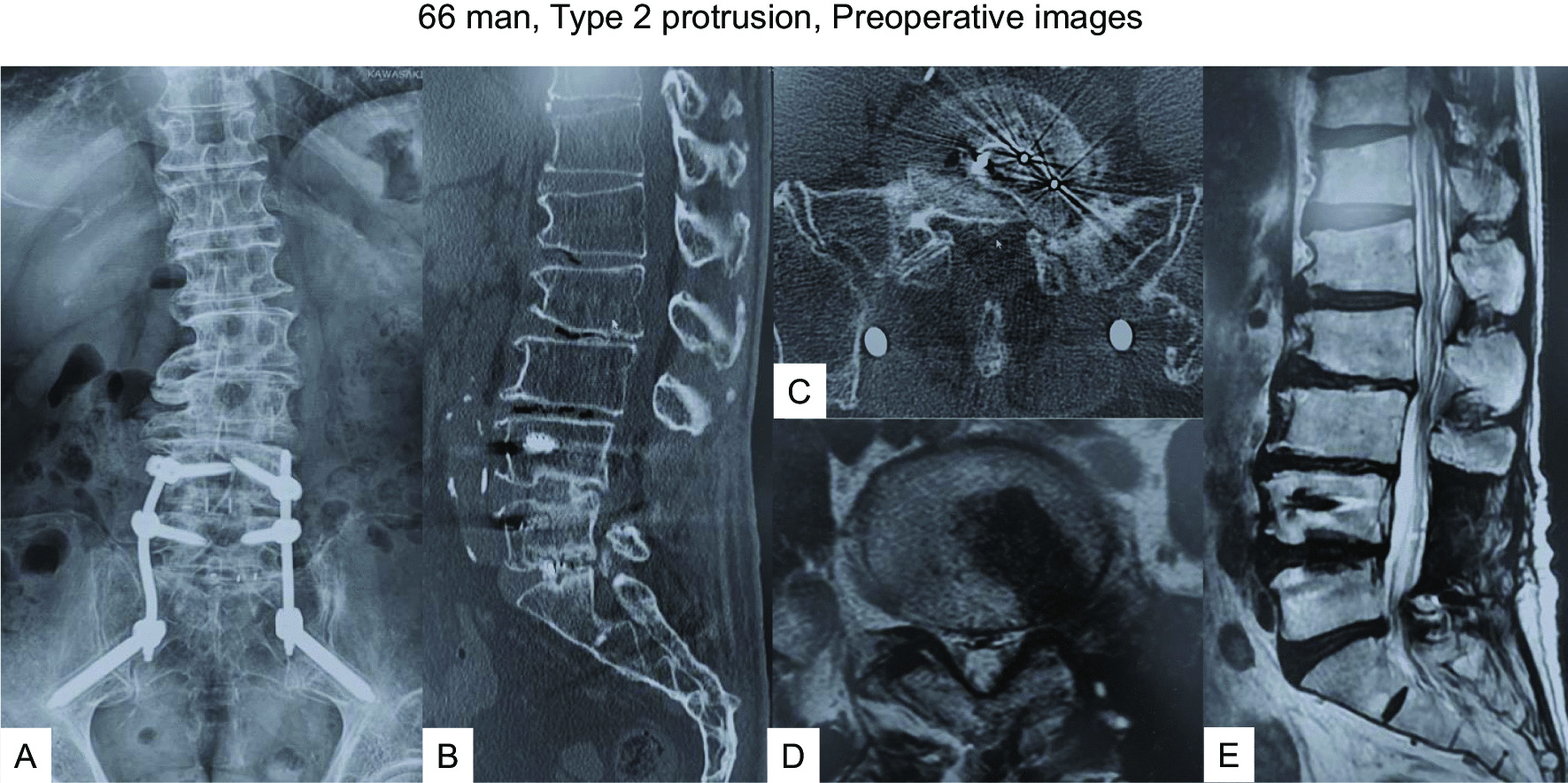 Fig. 4