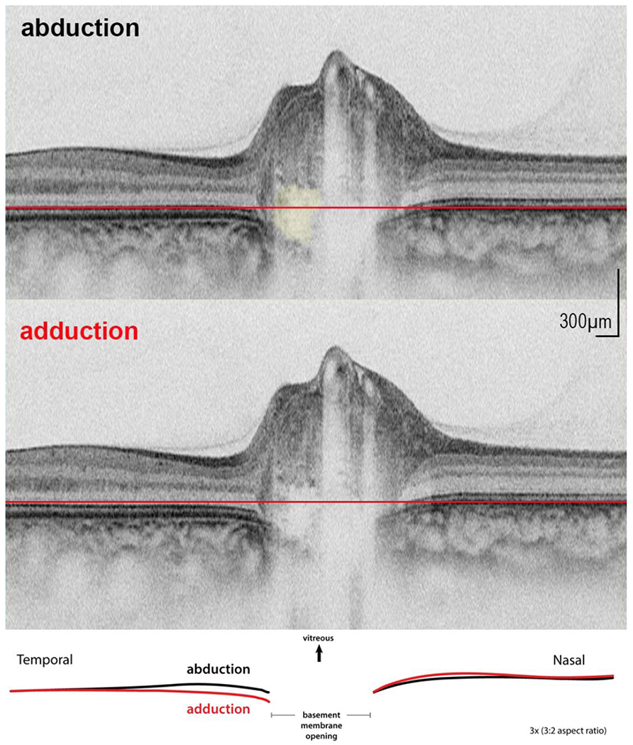 FIGURE. 3