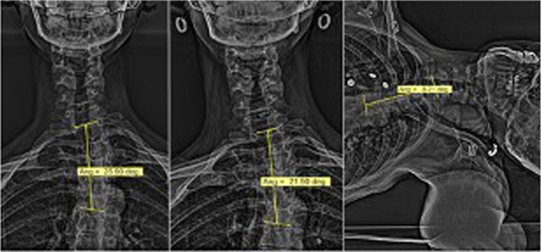 Fig. 2.