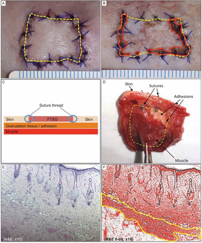 Fig. 2 (A-F). Tissue analysis technique.